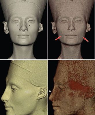 На обличчі Нефертіті знайшли сліди пластичної операції. ФОТО