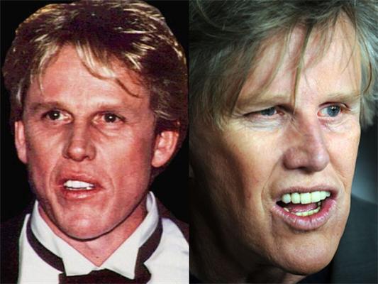 Невдалі пластичні операції знаменитостей 