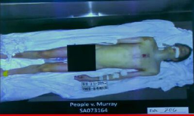 Обнародовано шокирующее фото Майкла Джексона после вскрытия. Фото