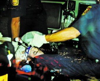 Обнародовано шокирующее фото Майкла Джексона после вскрытия. Фото