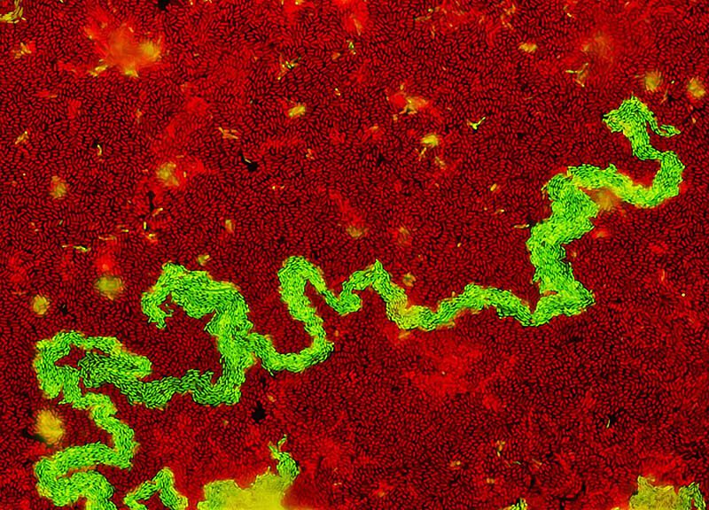 Работы финалистов конкурса микрофотографии Olympus BioScapes