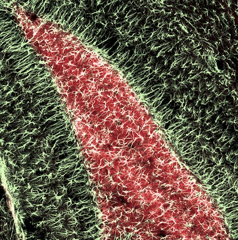 Работы финалистов конкурса микрофотографии Olympus BioScapes