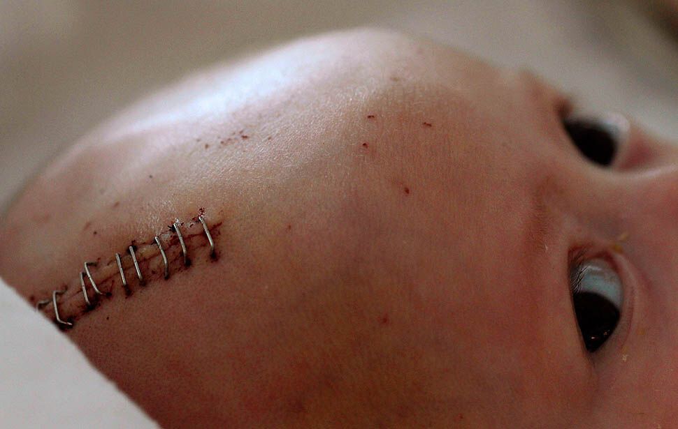 Спасение маленького Дилана Катания