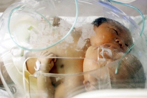В Китае появился на свет двухголовый младенец. Фото. Видео