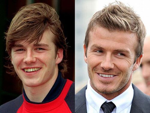 Голливудские звезды до и после стоматолога.Фото