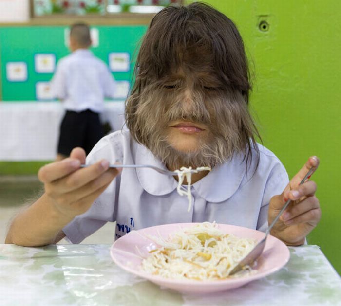 Девочка-оборотень: фото не для слабонервных 