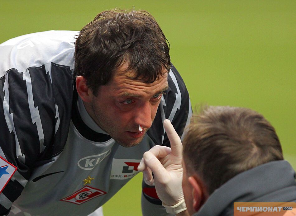 Вратарь сборной Украины получил серьезные переломы костей черепа. Фото, видео 