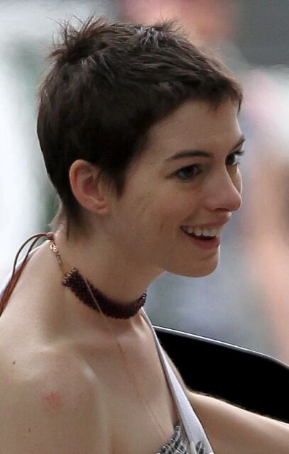 Энн Хэтэуэй травмировала руку. Фото