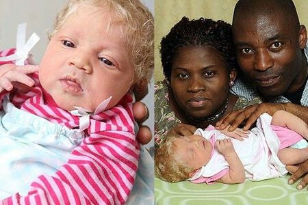 В Италии у темнокожей пары родился белый ребенок