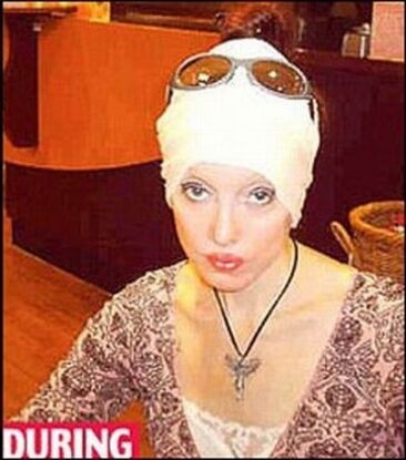 Женщина сделала 53 операции, чтобы стать Нефертити