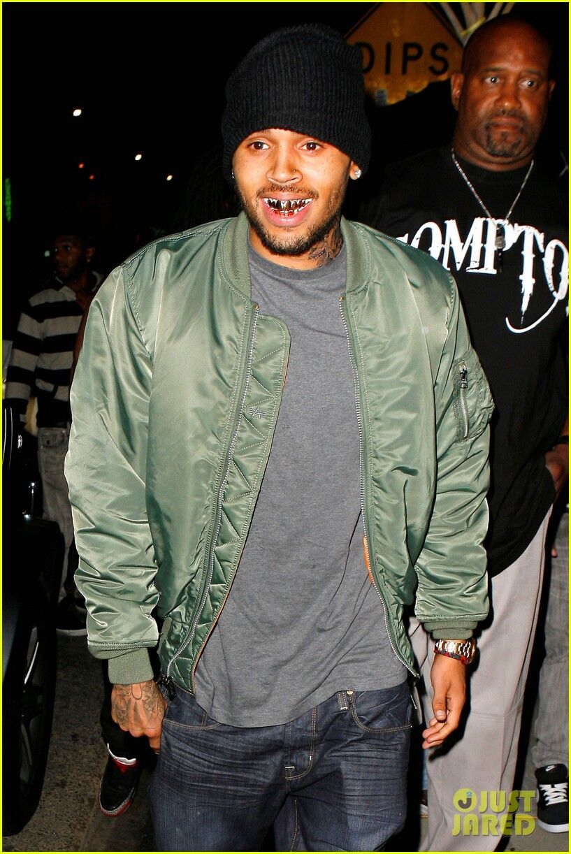 Крис Браун украсил свои зубы. Фото