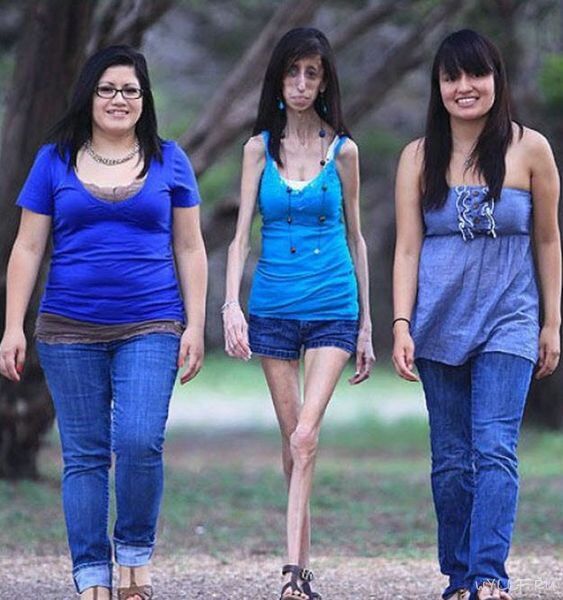 Самая некрасивая женщина в мире. Фото