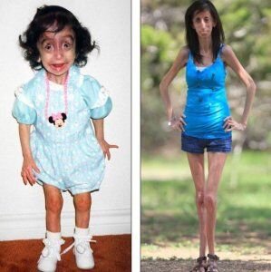 Самая некрасивая женщина в мире. Фото