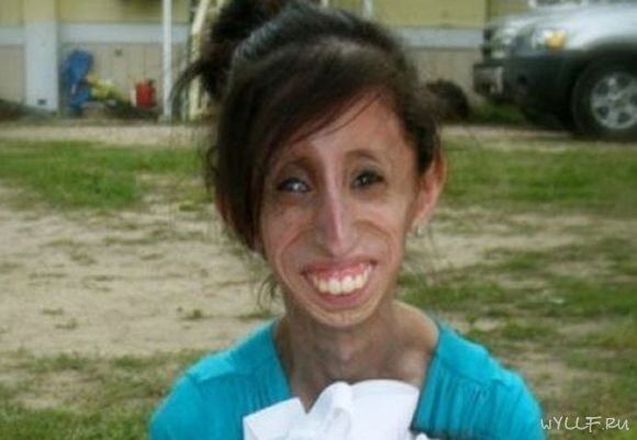 Самая некрасивая женщина в мире. Фото