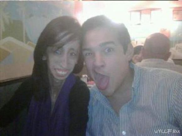 Самая некрасивая женщина в мире. Фото