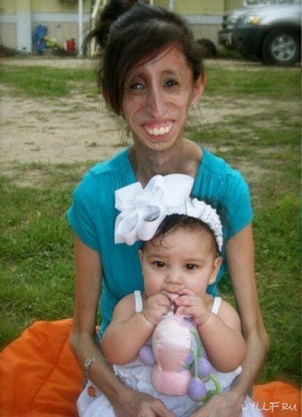 Самая некрасивая женщина в мире. Фото