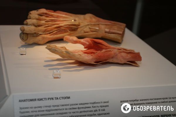В Киев привезли выставку человеческих тел, печени и легких
