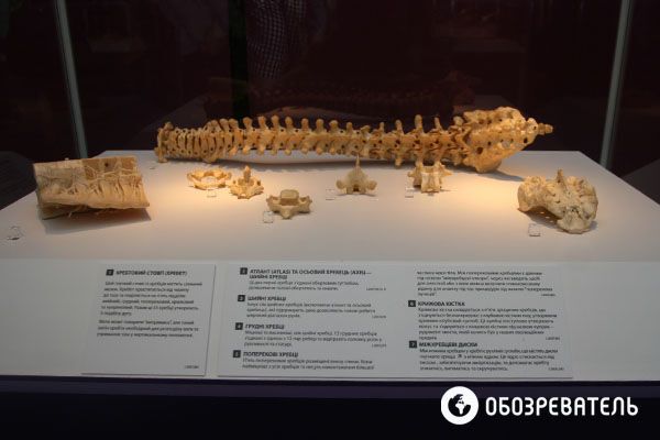 В Киев привезли выставку человеческих тел, печени и легких