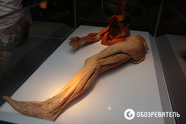 В Киев привезли выставку человеческих тел, печени и легких