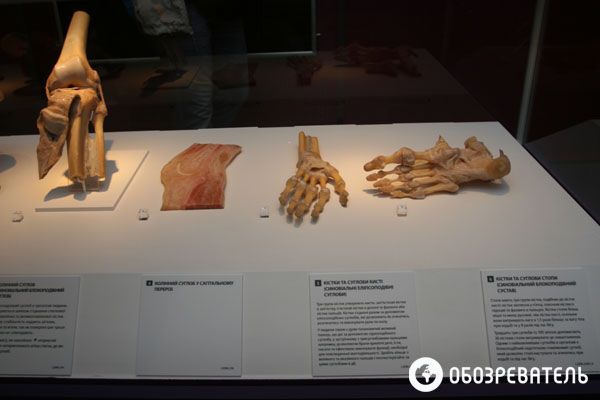 В Киев привезли выставку человеческих тел, печени и легких