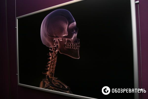 В Киев привезли выставку человеческих тел, печени и легких