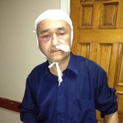 В Крыму совершено нападение на крымскотатарского активиста. Фото