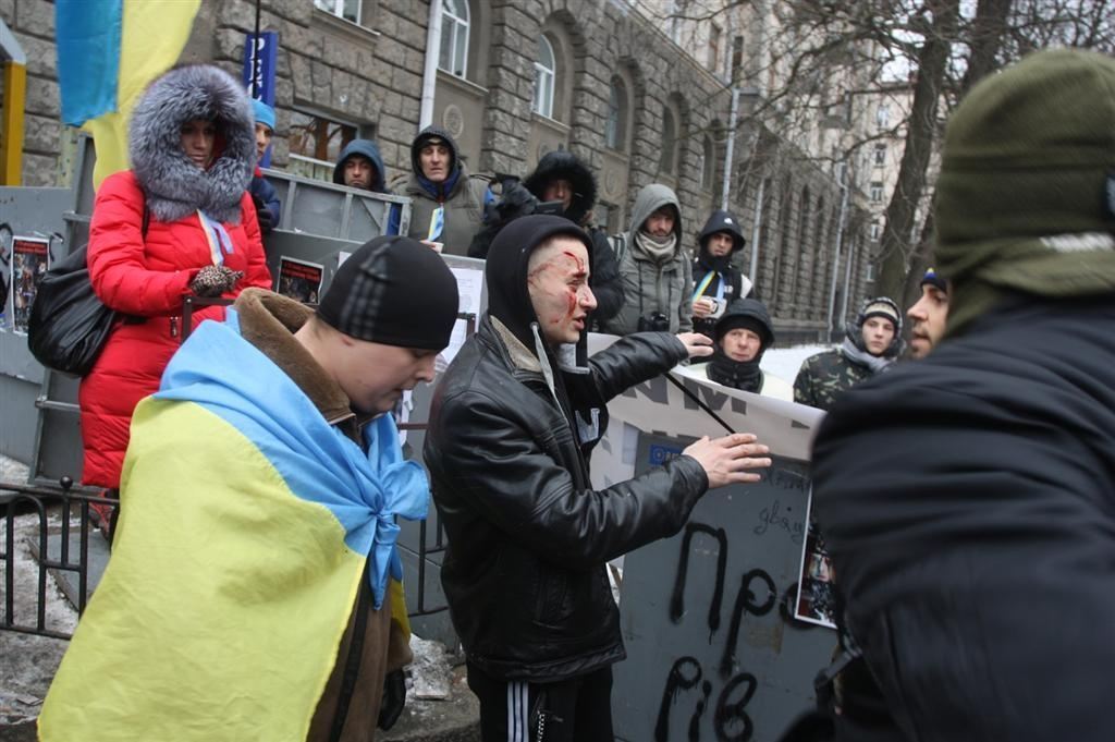 На Банковой появился человек в крови