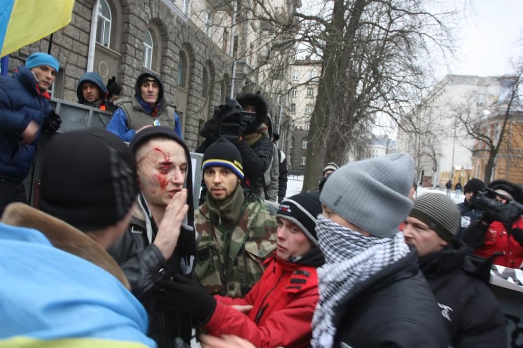 На Банковій з'явилася людина в крові