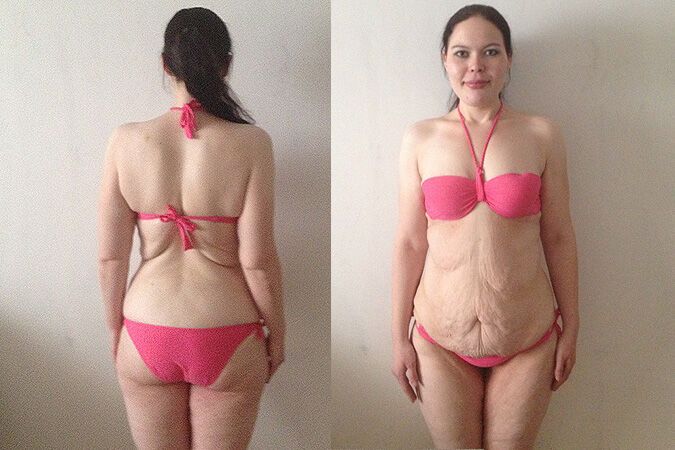 Россиянка за два года похудела на  75 кг. Фото