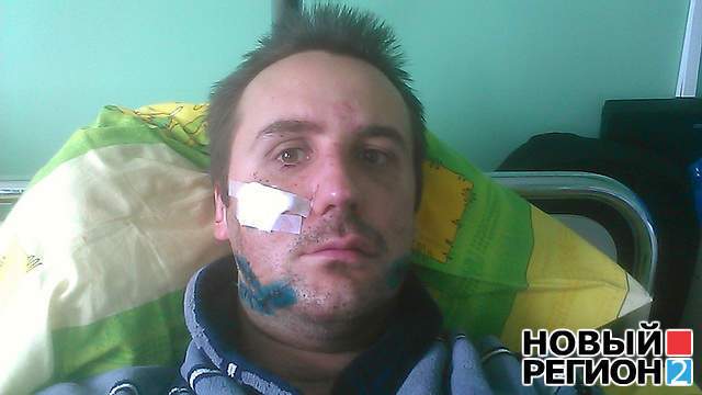 Избиение журналиста в Запорожье: пострадавший все еще в больнице