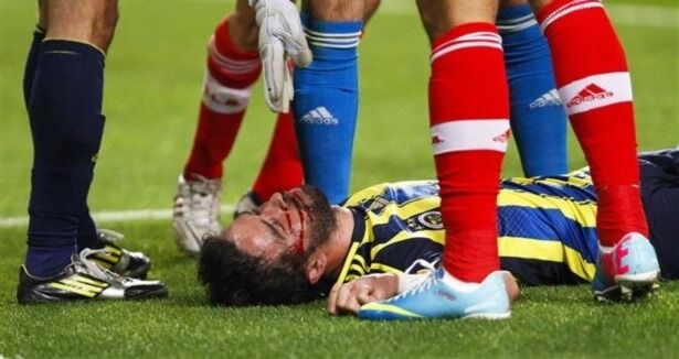 Жуткая травма игрока в полуфинале Лиги Европы. Фото. Видео