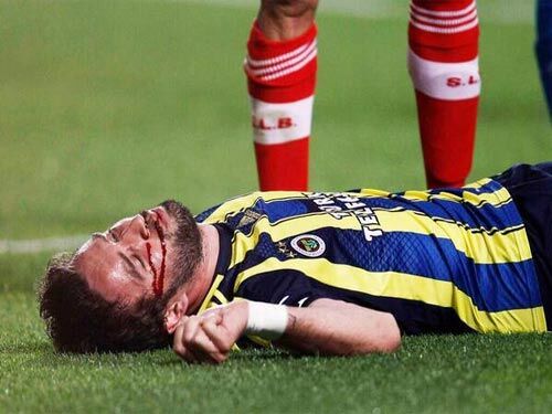 Жуткая травма игрока в полуфинале Лиги Европы. Фото. Видео