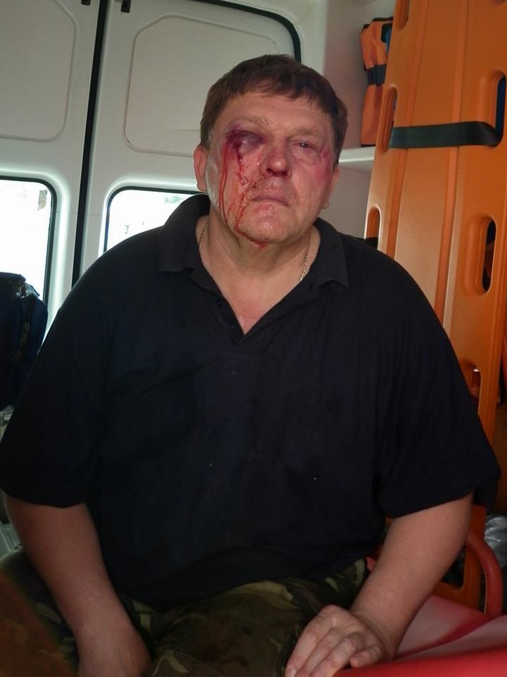 В столице избили бригаду "Киевводоканала"