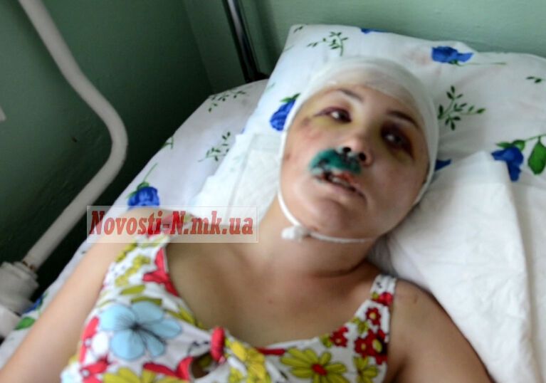 Жительница Николаевщины утверждает, что ее насиловали двое милиционеров
