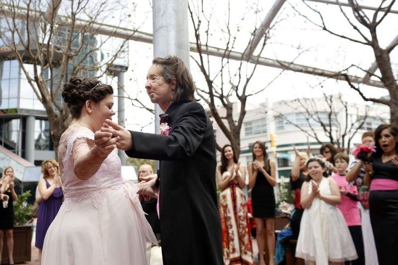 Человек с пересаженным лицом женился на жертве ДТП