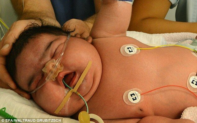 В Германии женщина родила ребенка-гиганта без кесарева
