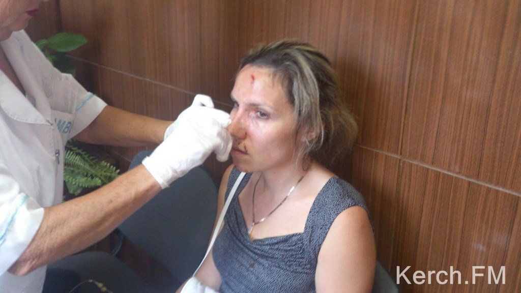 У Криму депутат до крові побив сімейну пару