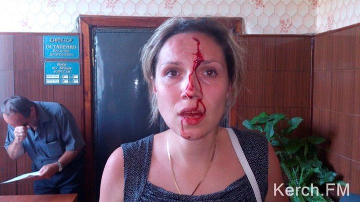 У Криму депутат до крові побив сімейну пару