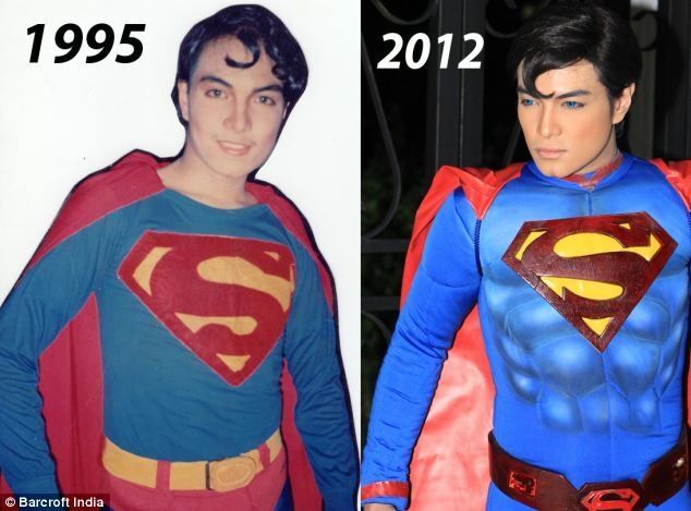 Мужчина пережил 19 пластических операций, чтобы стать Суперменом