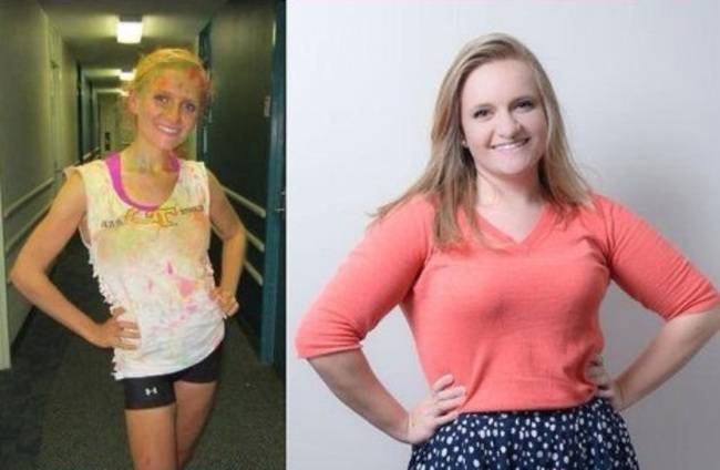 Истории девушек, победивших анорексию и их фотографии в стиле ''до и после''