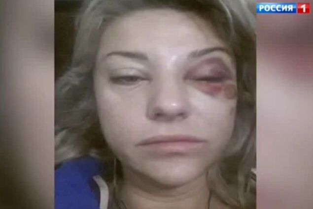 Марат Башаров избил жену до состояния комы