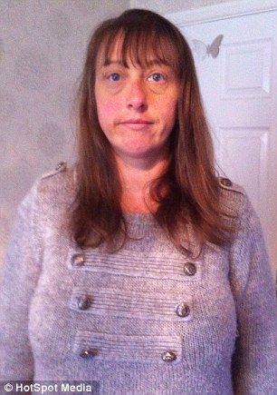 Страшная аллергия на краску для волос изуродовала женщину до неузнаваемости