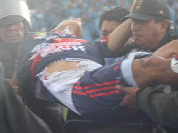В Перу футболиста ударило молнией во время матча: фото, видео