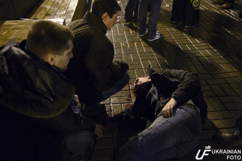 В Киеве произошла кровавая драка украинских и французских фанатов: фото пострадавших