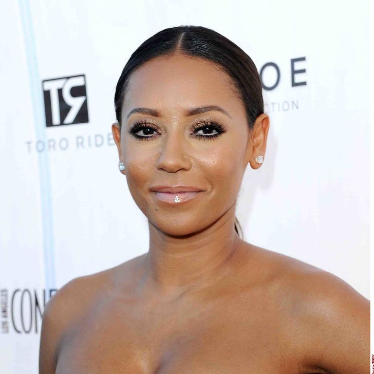 Экс-участница Spice Girls шокировала зрителей телешоу синяками по всему телу