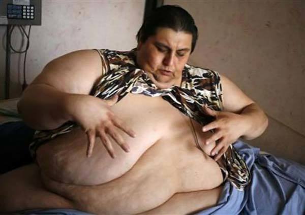 Самый толстый человек в мире умер при попытке похудеть
