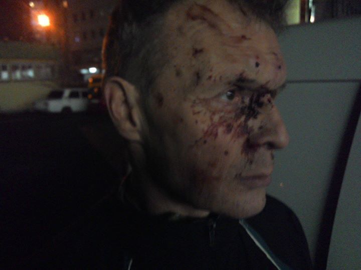 В Киеве мажор жестоко избил отца добровольца из "Азова": опубликовано фото