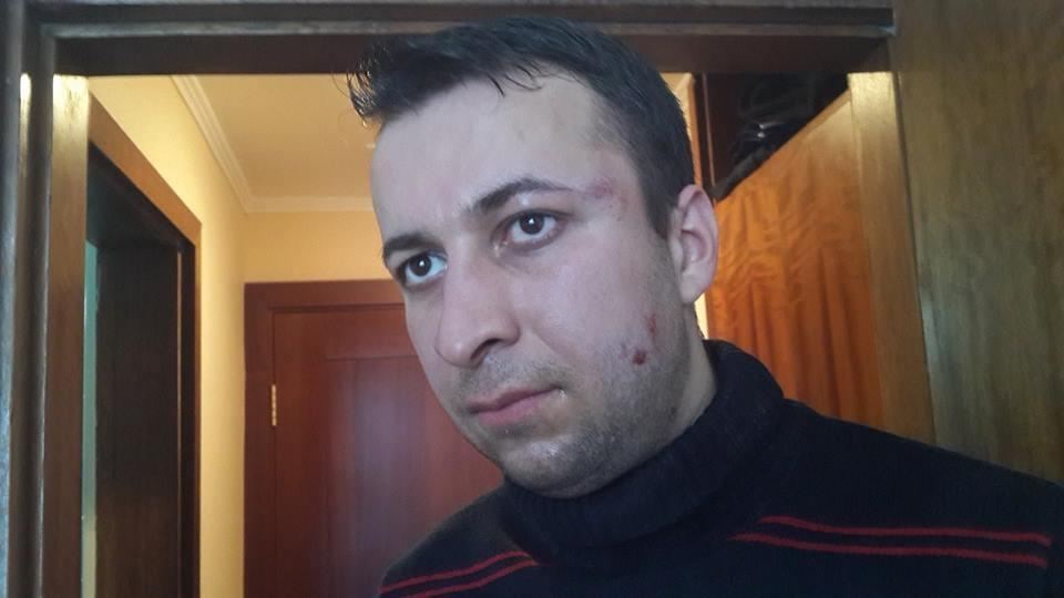 Беркутовцы избили журналиста и оператора "5 канала"