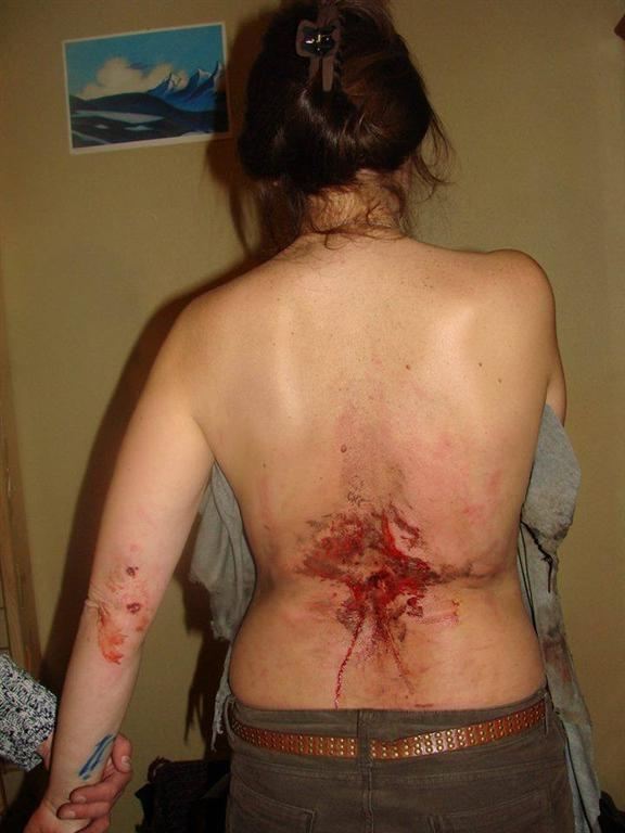 Киянка, в яку потрапила граната: я знала, на що йду