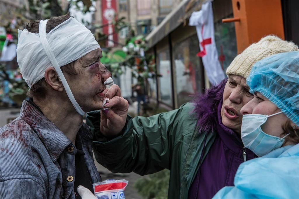 Самые страшные фото Майдана